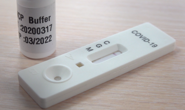 На експрес-тести на COVID-19 для медзакладів Києва витратять 30,5 млн гривень