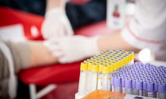 У столиці виїзні бригади Київського міського центру крові працюють за постійними адресами (перелік)