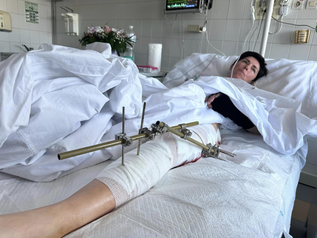 gendirektor ukrinformu vidvidav u likarni vlaskora olgu zvonarovu poranenu pid chas obstrilu zaporizhzhja d3ffe02