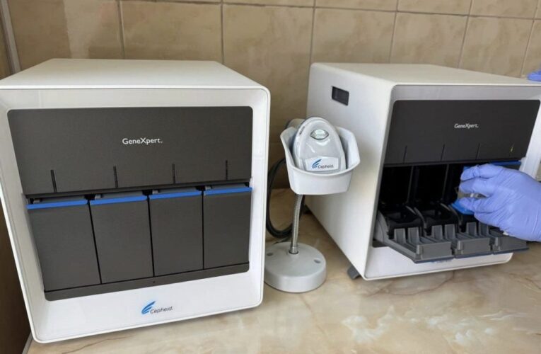 Чернівецький обласний медичний центр соціально значущих хвороб отримав нове обладнання