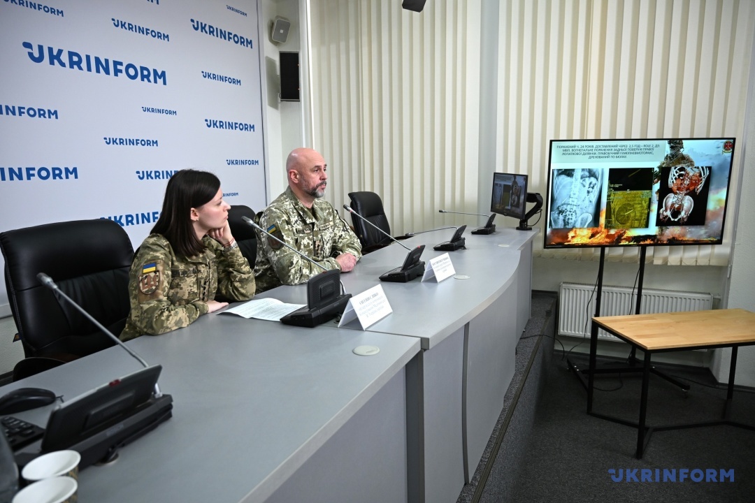 golovnij hirurg zsu harakter suchasnoyi bojovoyi travmi kardinalno zminivsja 11223b1