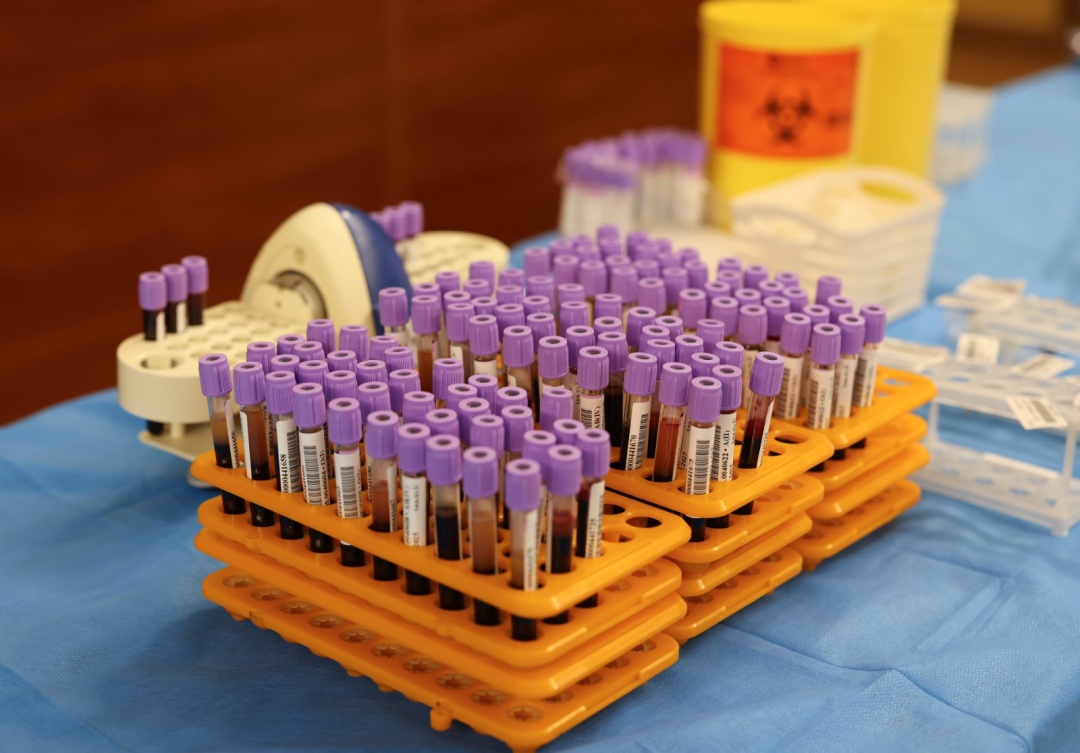 pracivniki dkvs zdali 35 litriv krovi dlja poranenih vijskovih ta civilnih b540ae0